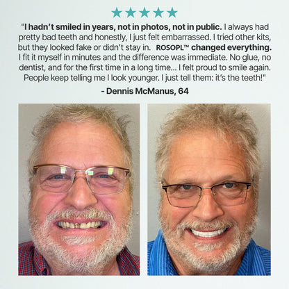 🌎 ROSOPLTM Custom-Fit Dentures ⏰ ENDS TODAY • 49% OFF | Smile with Confidence