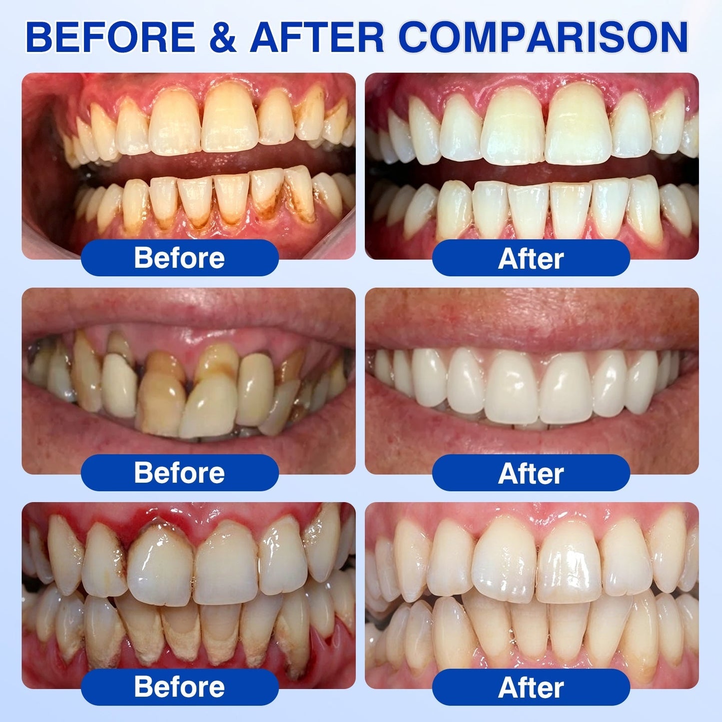 🦷👨‍⚕️ Professional Oral Care