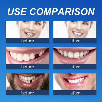 Ends Today: 50% OFF! ⏰ KLENIMORE™ Custom-Fit Smile Support Set — Strong Hold & Natural Look 🦷