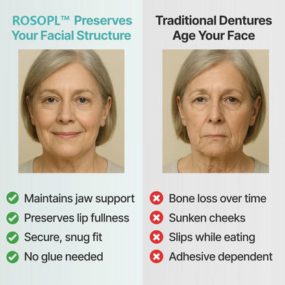 🌎 ROSOPLTM Custom-Fit Dentures ⏰ ENDS TODAY • 49% OFF | Smile with Confidence