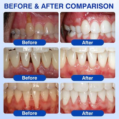 🦷👨‍⚕️ Professional Oral Care