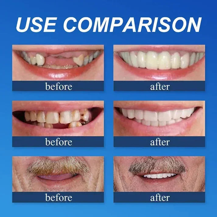 KLENIMORE denture set comparison