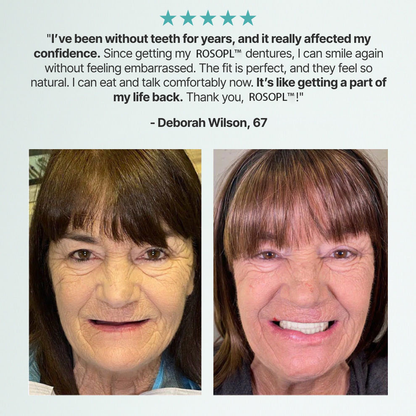 🌎 ROSOPLTM Custom-Fit Dentures ⏰ ENDS TODAY • 49% OFF | Smile with Confidence