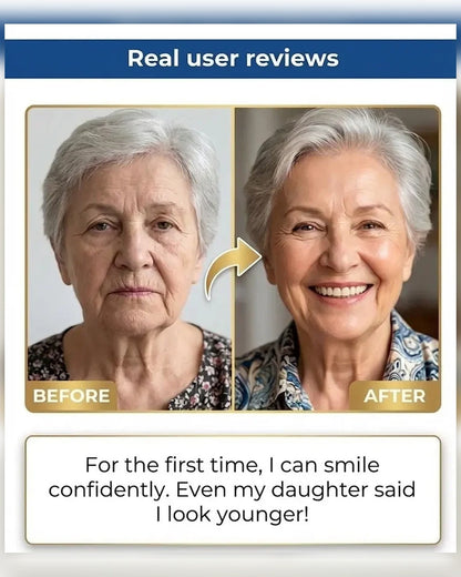 🏆Ends Today: 50% OFF! 🏆2026 Bestselling Product🦷 Fit for a Fresh Smile, Say Goodbye to Wearing Discomfort!